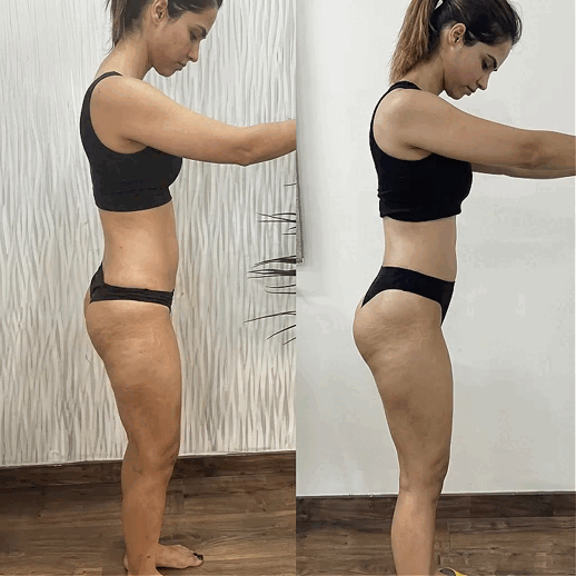 NextGen Ultra Glute Stimulator