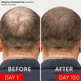 APE BORN Red Light Therapy Hat