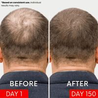 APE BORN Red Light Therapy Hat